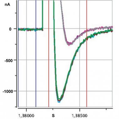 Cardiac Na+ Channels