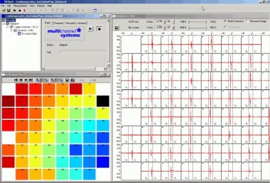 Cardiac Signals