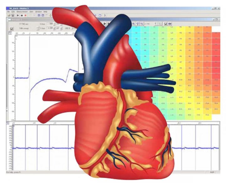 General Cardiac Applications